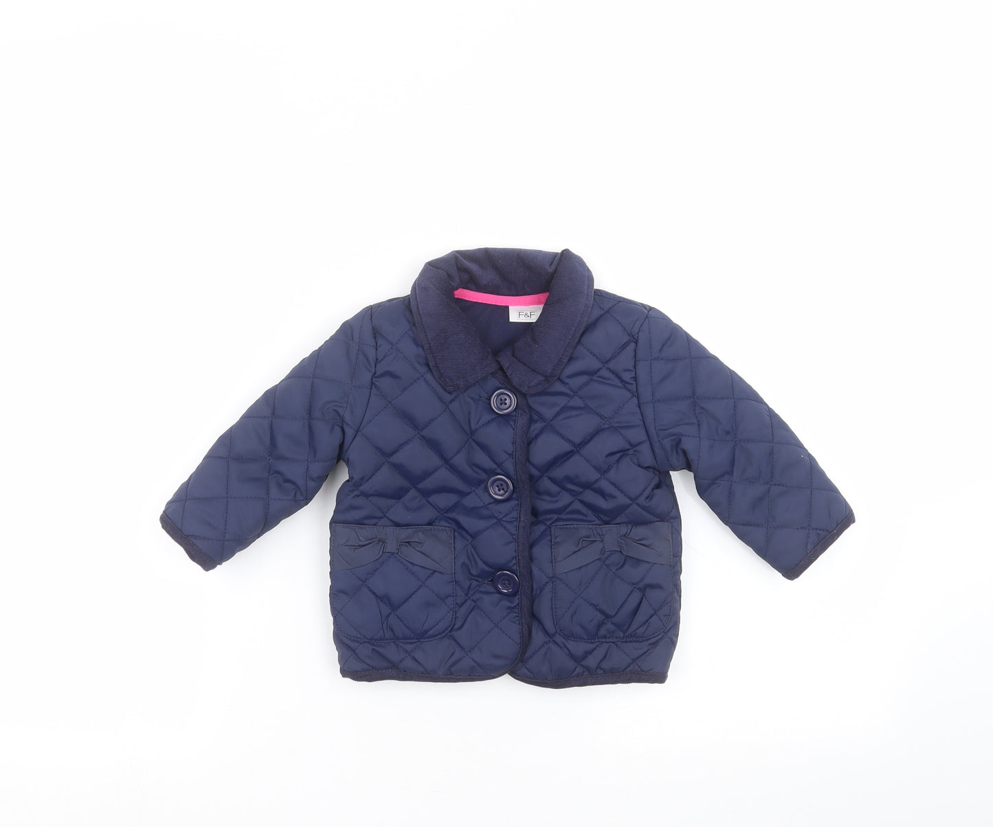F&F Baby Blue   Pea Coat Coat Size 6-9 Months